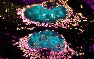 Estudo de SP revela proteína bacteriana capaz de manter a célula humana saudável
