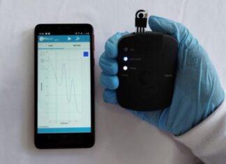 Sensor permite teste de urina para detectar doenças como câncer, gota e Parkinson
