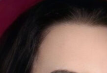 Remoção e transplante de sobrancelhas crescem com busca por naturalidade