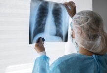 Além do tabagismo, obesidade e inflamação também são prejudiciais aos pulmões