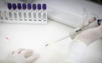 São Paulo investiga caso suspeito de Ebola e mantém vigilância em saúde no estado